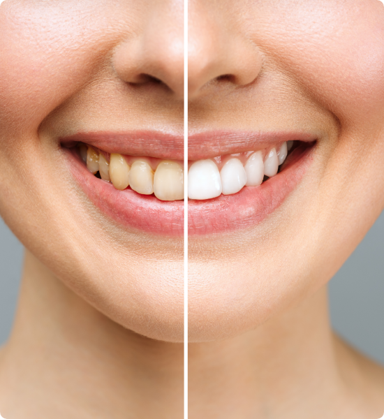 Estetica Dentale Torino