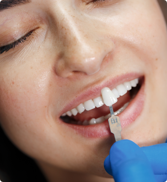 Estetica Dentale Torino