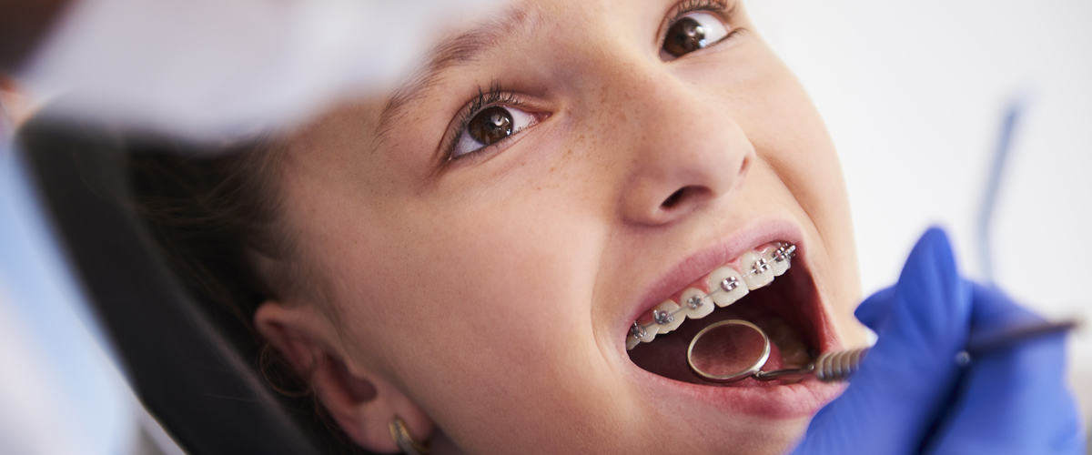 dentista di famiglia Torino centro e bambini