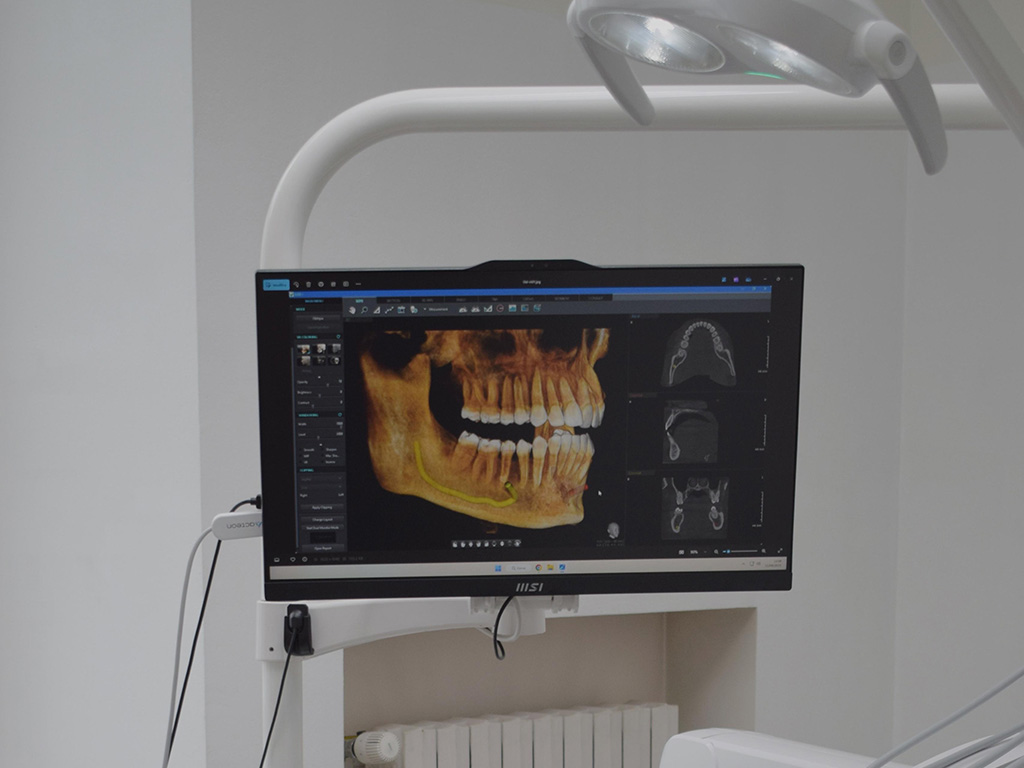 Centro dentistico Torino Via Cernaia Dott. Sannicolo