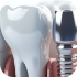 Dentista Torino