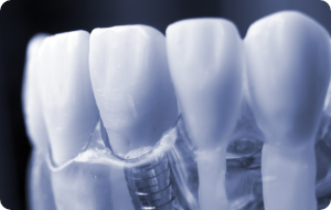 Dentista Torino